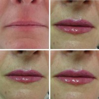 /album/fotogalerie/rty-ivet-24-3-2017-jpg/